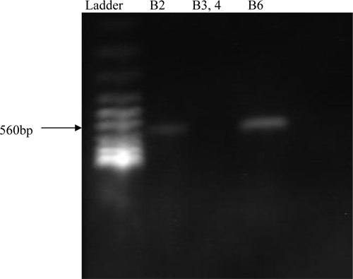 PCR Results of amplification of both Non-HS-Causing and HS-Causing vaccinal strains of P. multocida but only HS-Causing strain is amplified