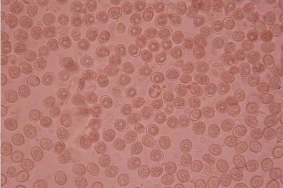 Processed blood indicating full fields of oocysts of E. zuernii