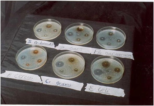 Agar plates inhibitory zones