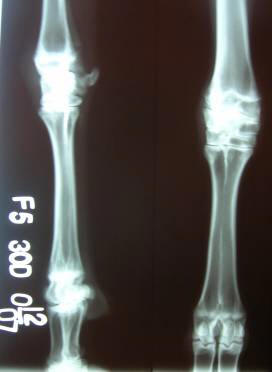 xray osteofluorosis