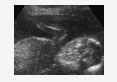 ultrasound bovine genetalia