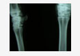 osteofluorosis in goats