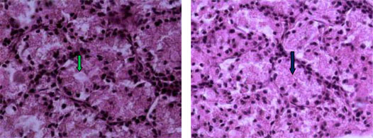 Histological sections of Dorsal lacrimal gland of Iranian river buffalo