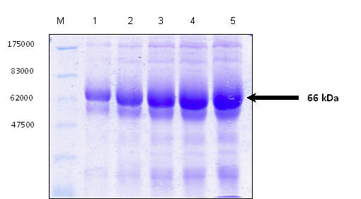 SDS-PAGE