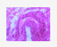 histoanatomical study lacrimal gland
