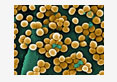 mrsa mastitis