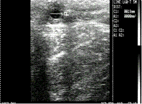 Ovarian Follicle