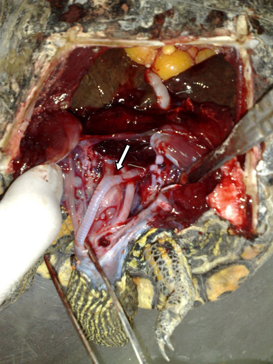 Bifurcation of bronchials from trachea