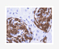 PRRSV AND PCV 2 INFECTION IN GREEK SWINE FARMS