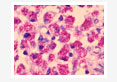 Conventional vs. Recombinant Antigen Based Detection of Mycobacterim avium subspecies paratuberculosis Infection in Animals