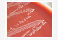 Vaginal Microflora and its Antibiogram in Infertile Bitches