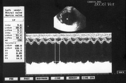 Dilated Cardiomyopathy in Dogs