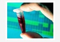 Biosensors: A Novel Approach for Pathogen Detection