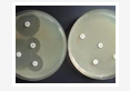 Antibiogram Profile and 16S rDNA RFLP Analysis of Enteric Bacteria from Farm Animals of Andaman Islands