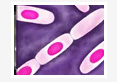 A-Study-on-the-Biotyping-of-Bacillus-cereus-Emetic-Strains-Isolated-from-Raw-Milk-and-Milk-Products-in-Kashmir-Valley