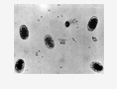 helminths